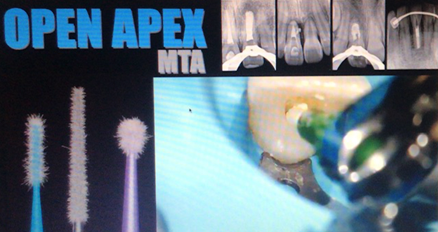 Conferencia virtual endodoncia